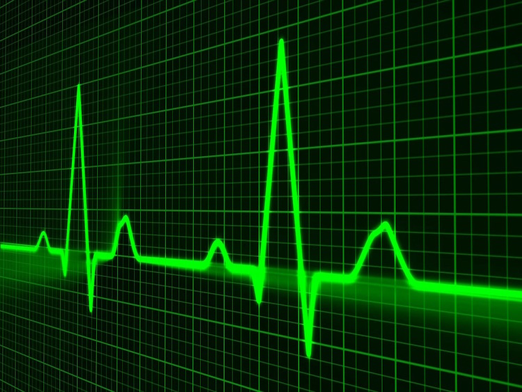 cardiac profiler interface image